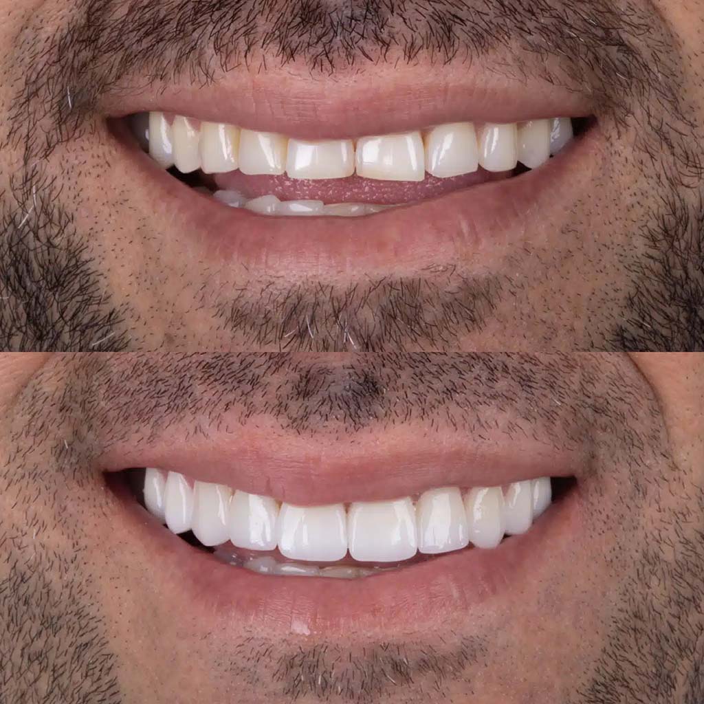 Camada 4